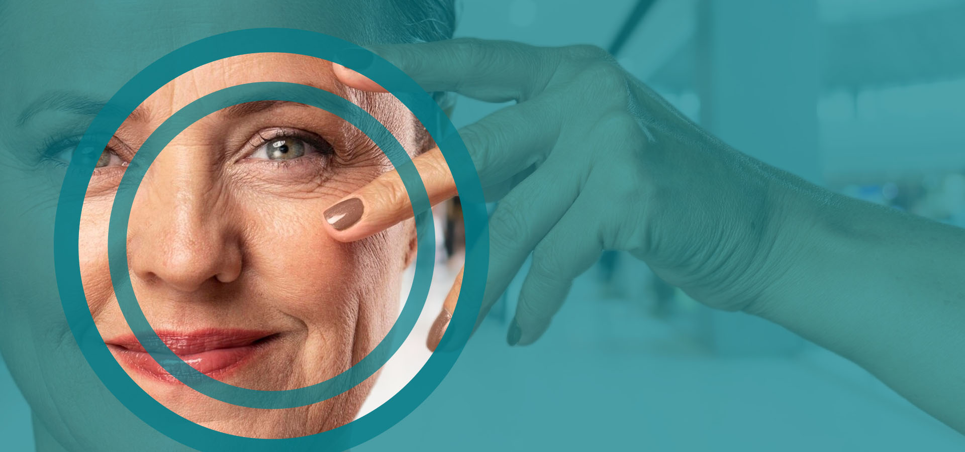Glaucoma Treatment